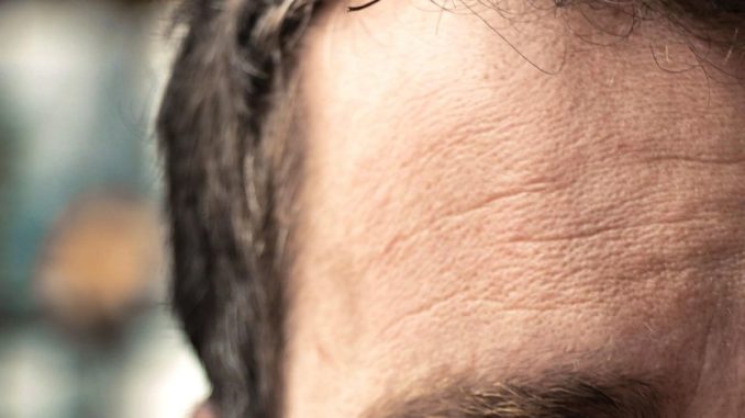 Falten Im Gesicht Reduzieren 10 Tipps Fur Manner Maennerdinge